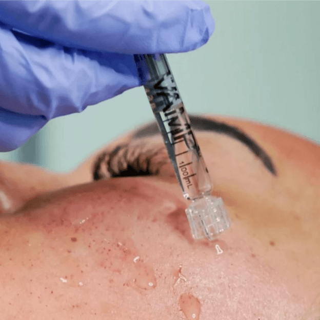 Glass Skin Duo at Aesthetik Nurse Kat in Riverside, CA