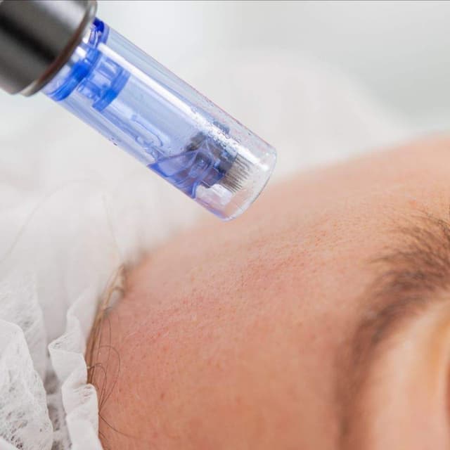 Liquid Gold Glow at Aesthetik Nurse Kat in Riverside, CA